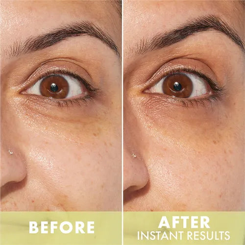 Lift & Contour 1% Bakuchiol & Peptide Eye Serum