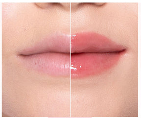 Lip Injection Maximum Plump